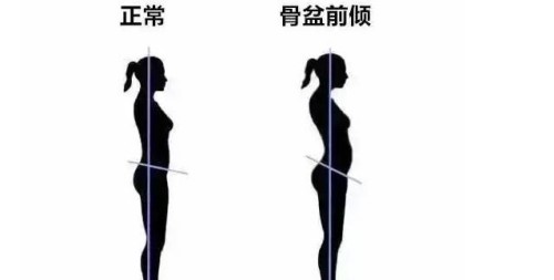 女子上环的几种方式介绍,女人上环好不好